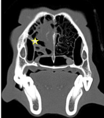 <p>What is this being used to diagnose, showing you destruction of the turbinates and overall integrity of turbinates and cribriform plate?</p>