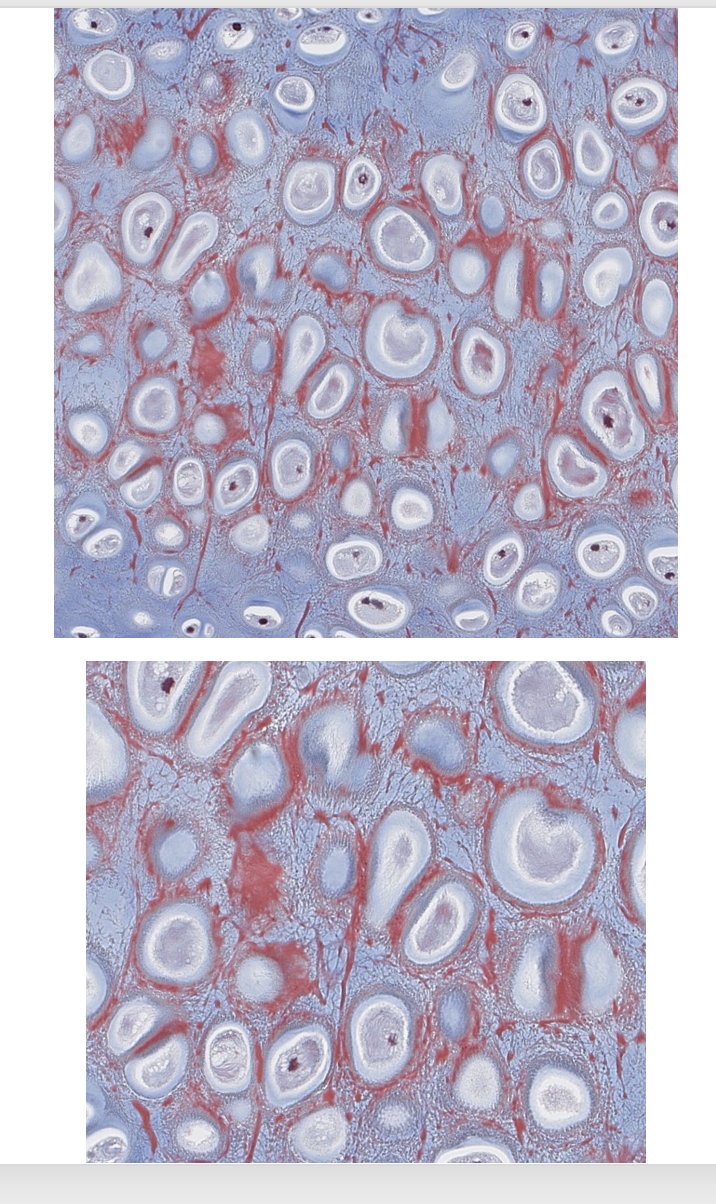 <p><span style="font-family: "Calibri Light";">Which type of CT is this?<br></span></p>