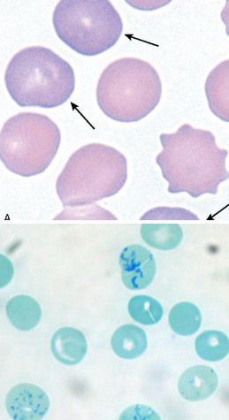 <p>8-8.5 micrometers</p><p>no nucleus present</p><p>cytoplasm is pinker but has blue/purple tint due to remnants of RNA and ribosomes</p><p>called “reticulocyte” when stained with supravital stain</p><p>can be released into the bloodstream and visualized on a blood smear</p>