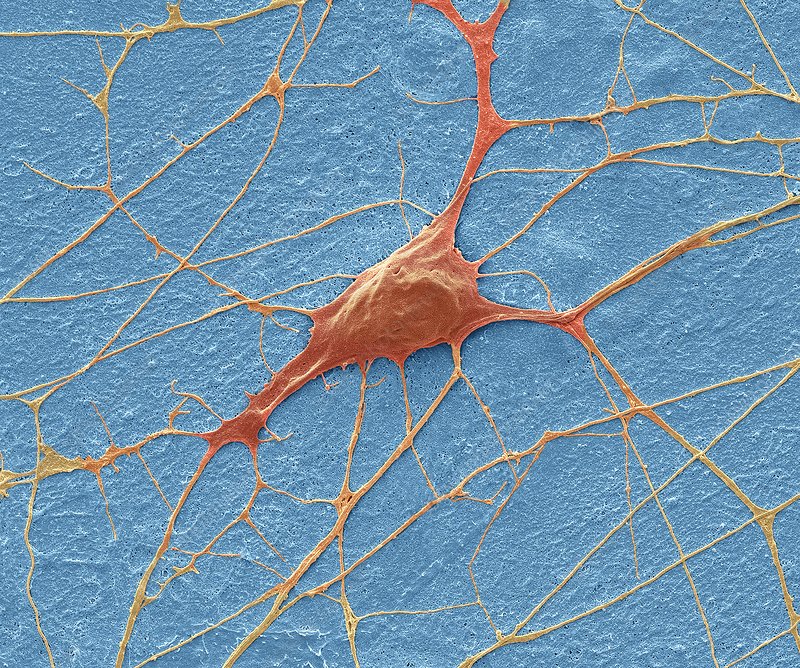 <p>What kind of human cell is this?</p>