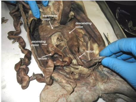 <p>descending colon</p>