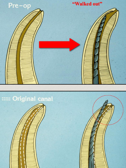<p>How do you establish a Glide Path?</p>