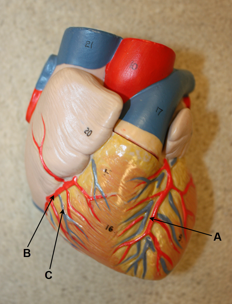 <p>In the images above and below, identify shallow depression A; and blood vessels B and C.</p>
