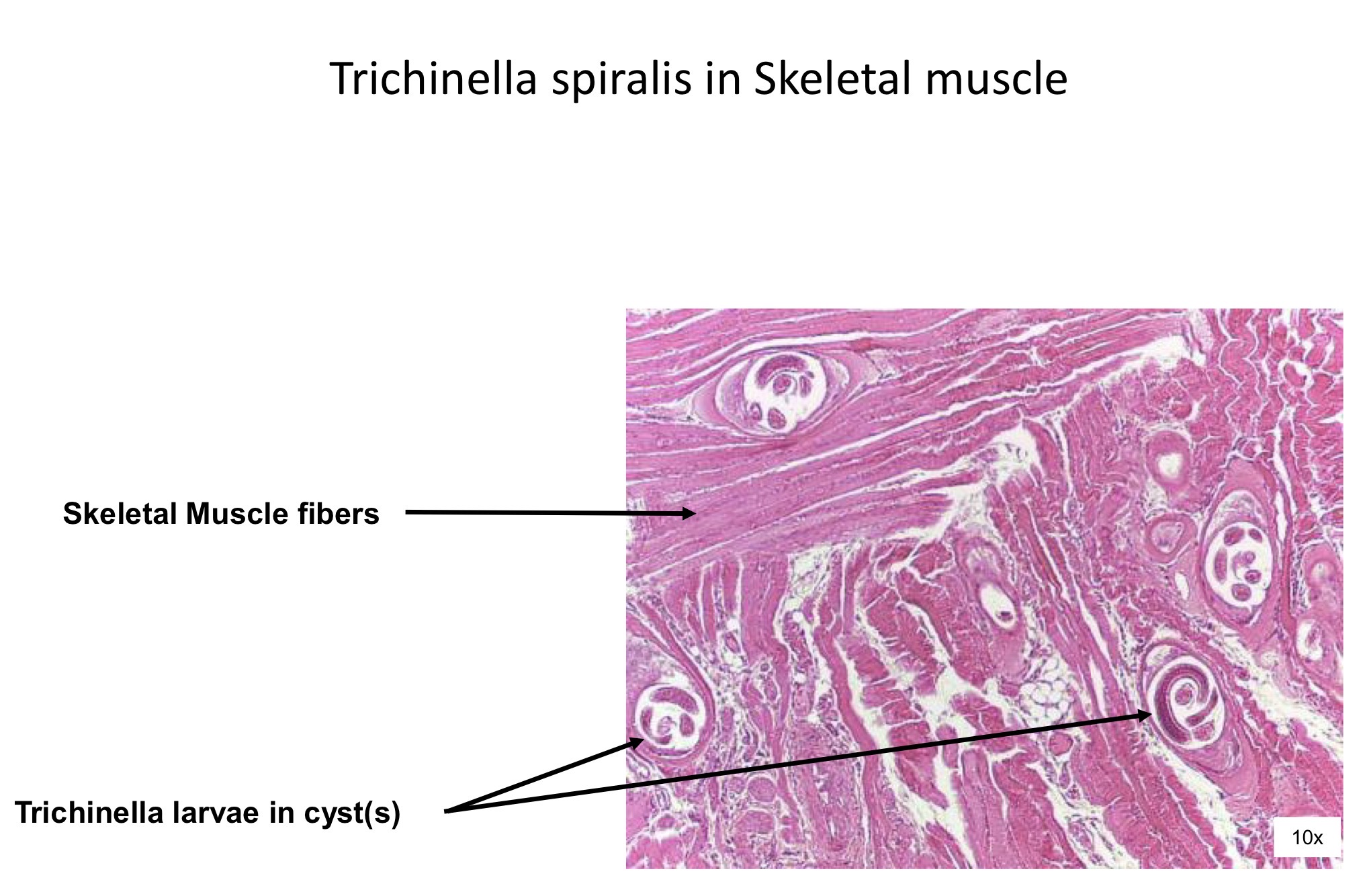 <ol><li><p>Skeletal muscle fibers </p></li><li><p>Trichinella larvae in cyst </p></li></ol><p></p>