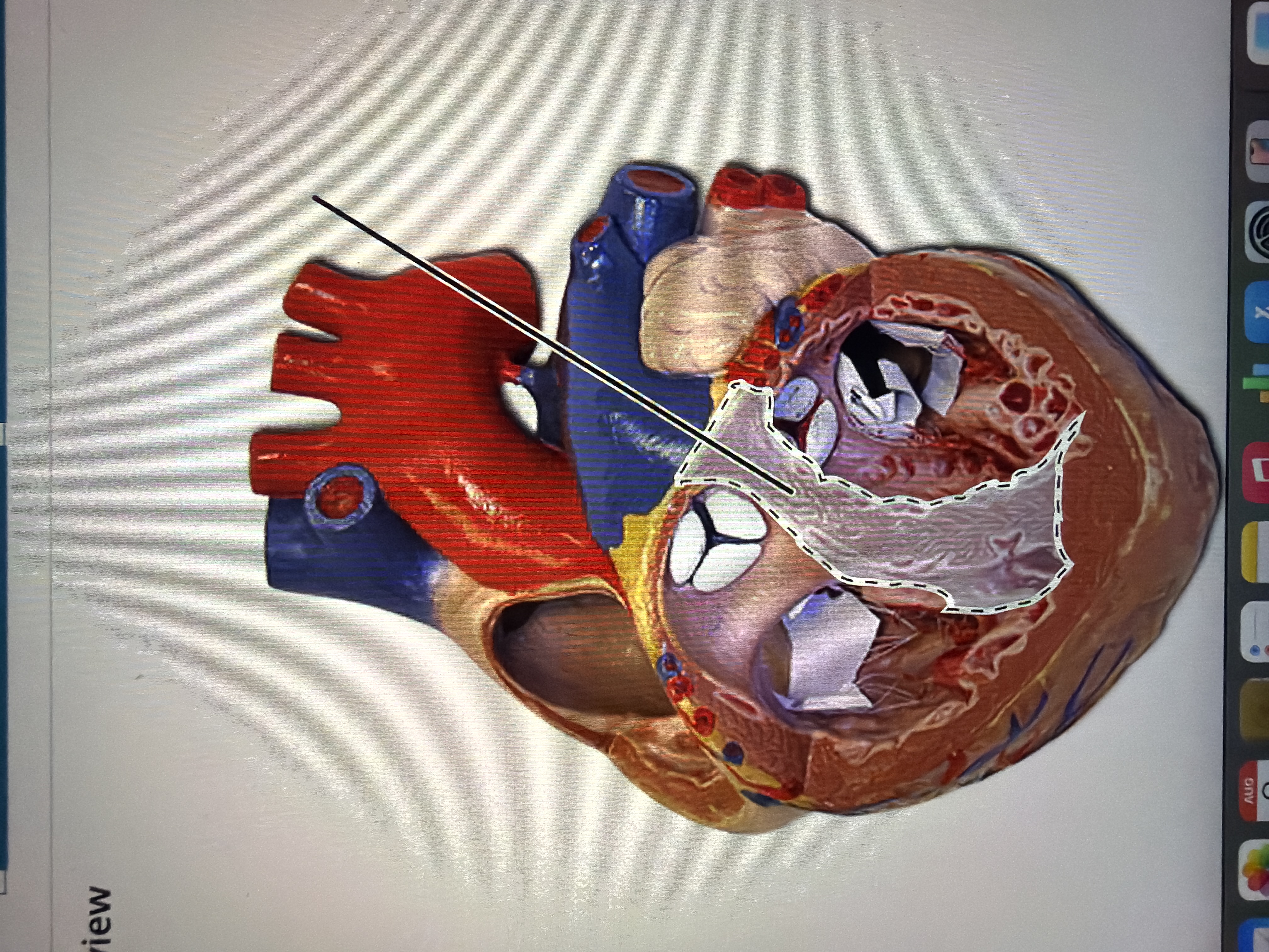 term image