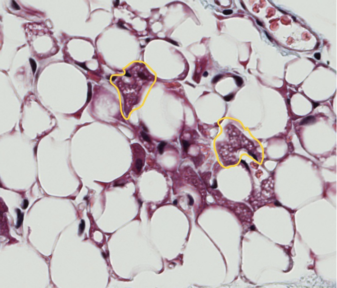 <ol><li><p>brown adipose tissues are encircled</p></li><li><p>white adipose cells are unilocular (one large lipid vacuole per cell). How do Brown cells differ?</p></li></ol><p></p>