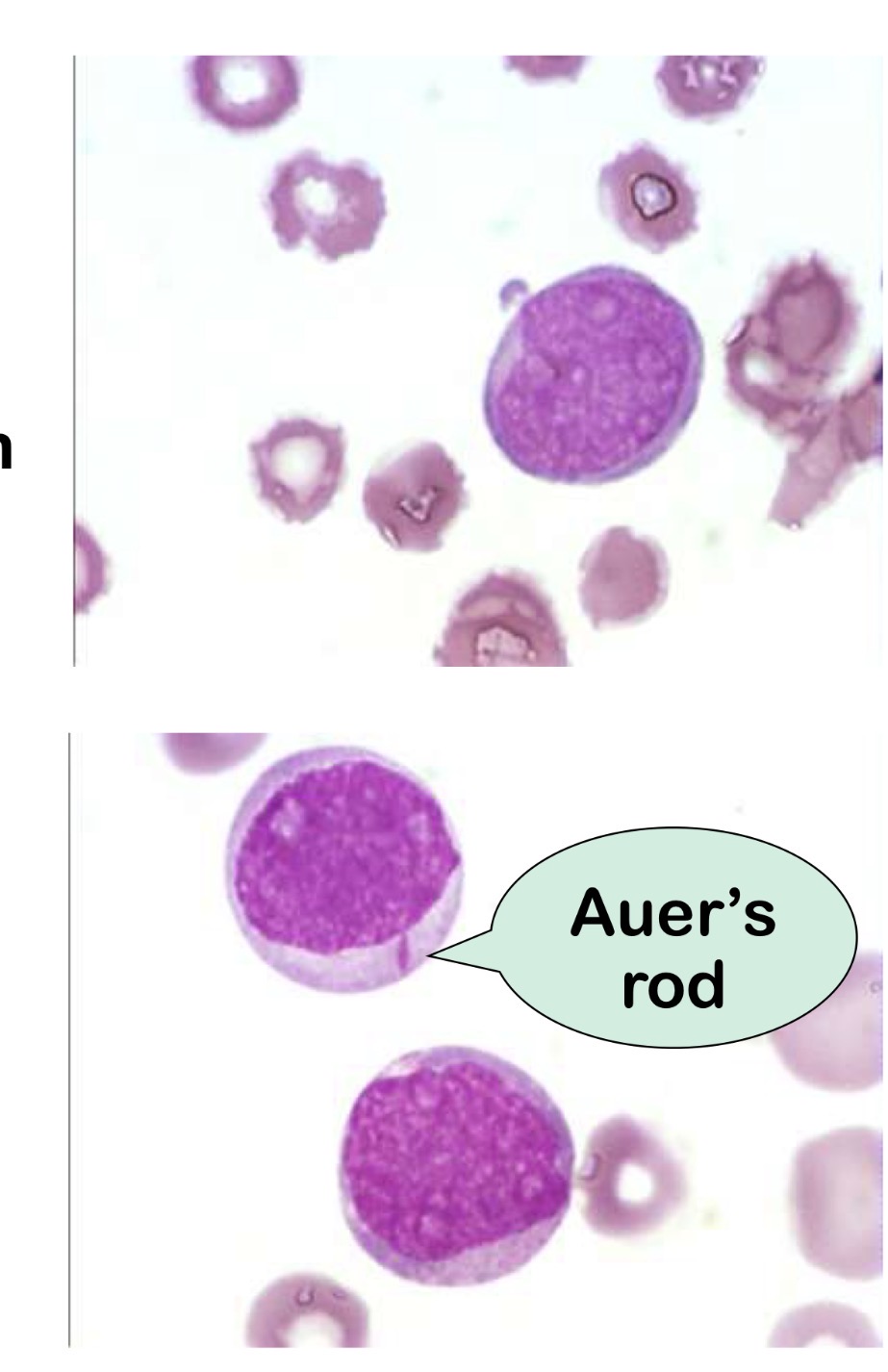 <p>Name this cell and the main points for identification</p>