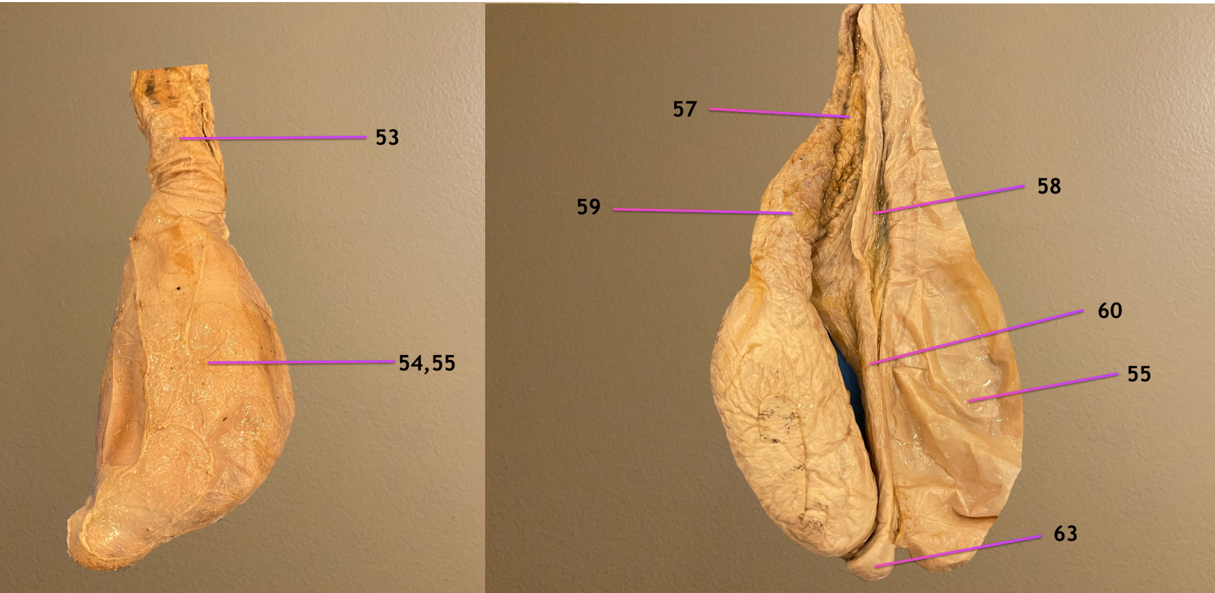 <p>view of testicle</p><p>.</p><p>label 53, 59, 60</p><p>.</p><p>label the CT 57, 58</p>