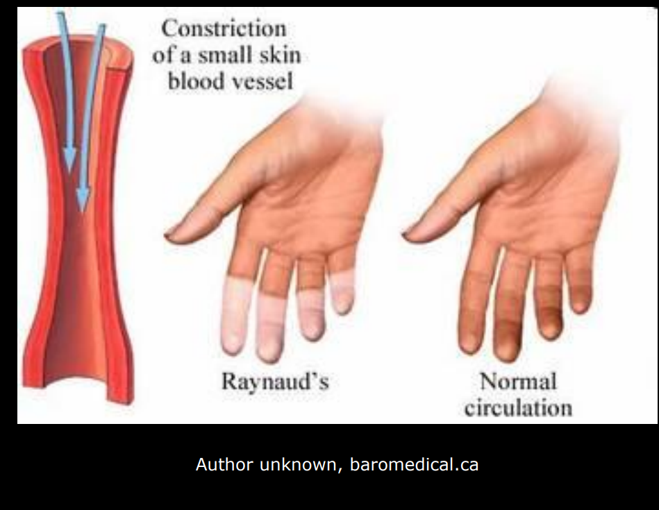 <p>May be first manifestation of a collagen disorder or other abnormality</p>