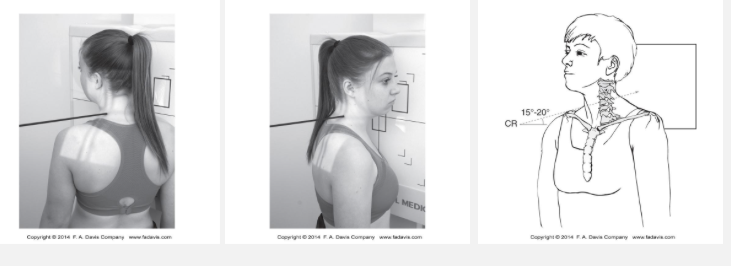 <p>What is visualized on an oblique cervical spine radiograph?</p>