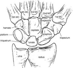 <p>scaphoid, lunate, triquetrum, pisiform, trapezium, trapezoid, capitate, hamate</p>