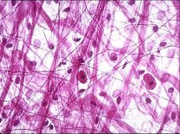 <p>which type of connective tissue is this?</p>