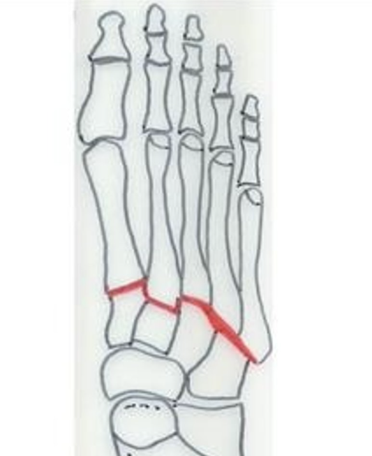 <p>What is this joint?</p>