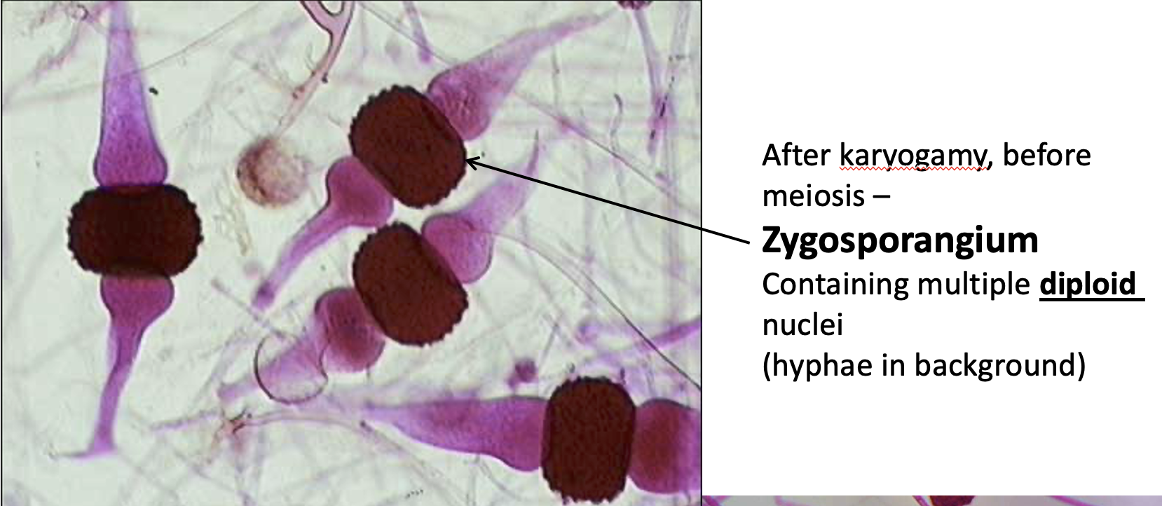 <p>This is the <strong>zygosporangia</strong> after <strong>karyogamy</strong> in zygomycota </p><p>Contains multiple <strong>diploid</strong> <strong>nuclei</strong></p><p>The hyphae is in the background</p>