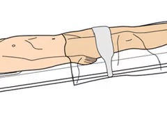 <p>Lying down with the feet elevated higher than the head</p>