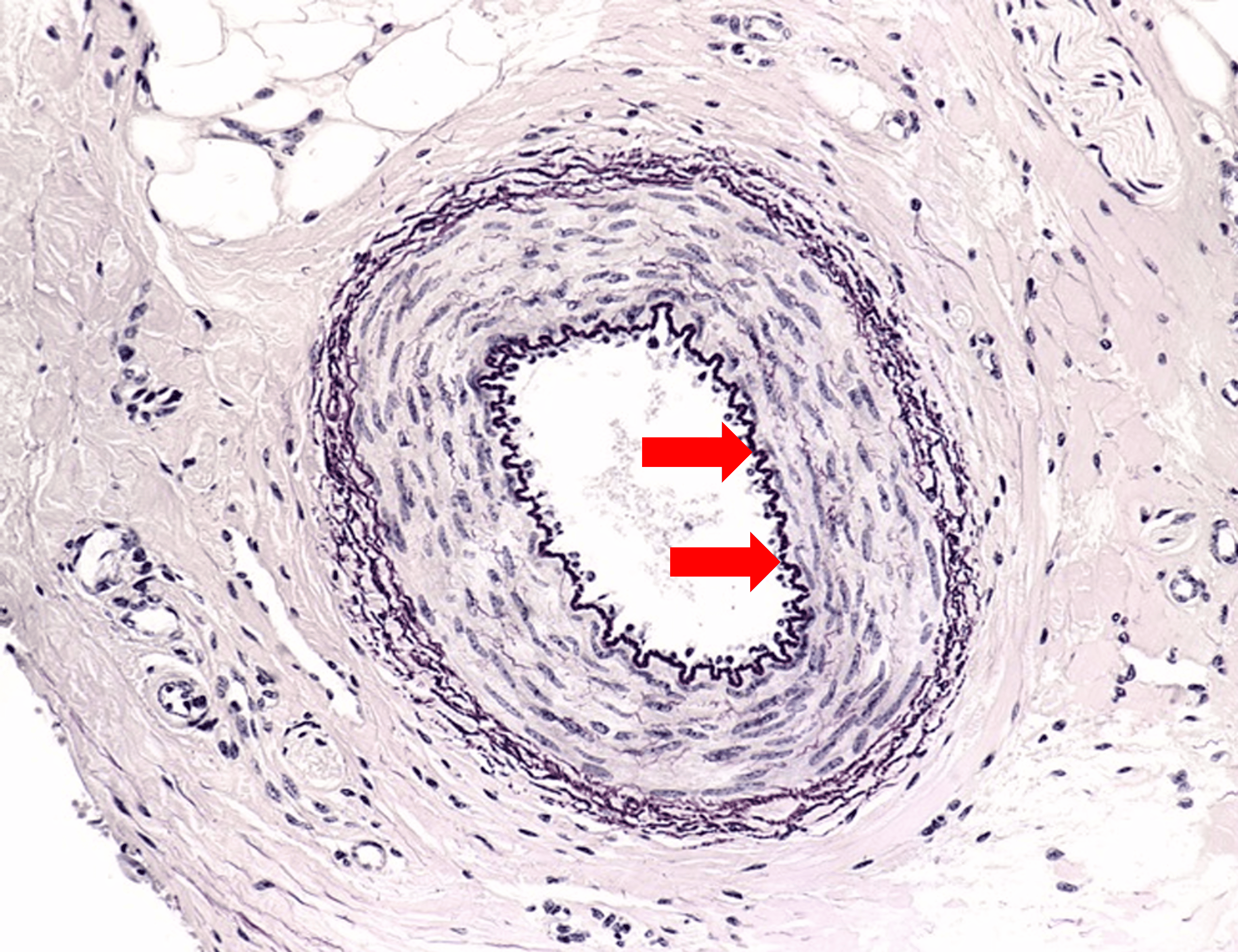 term image