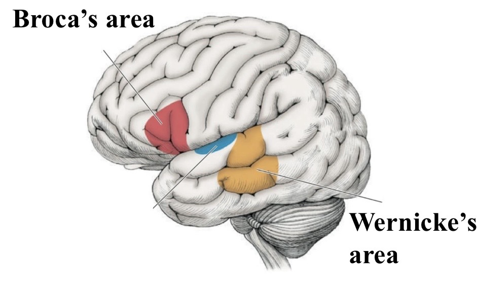 <p>Broca’s and Wernicke’s areas, damage or loss enables opportunistic study of imporance</p>