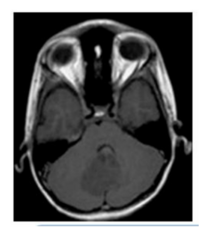 <p>A. T1 MRI, transverse section</p>