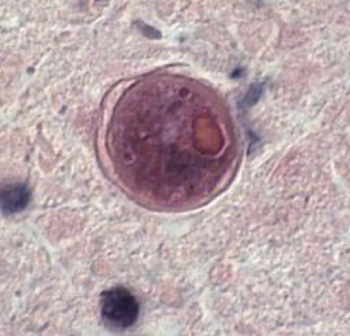 <p>Which amoeba is this? What form?</p>