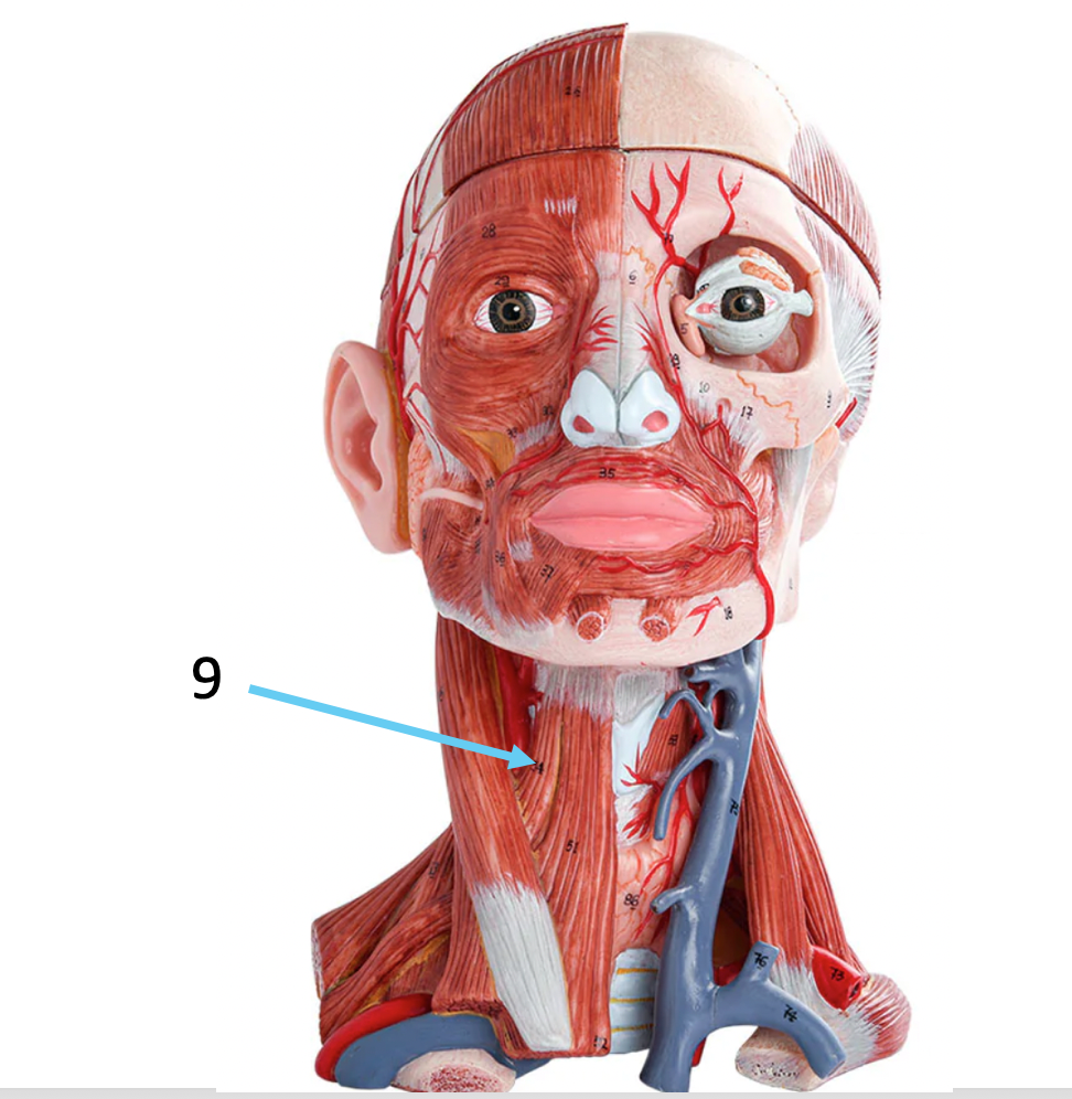 term image