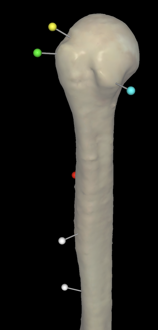 <p>What is the green pin called on the right humerus?</p>