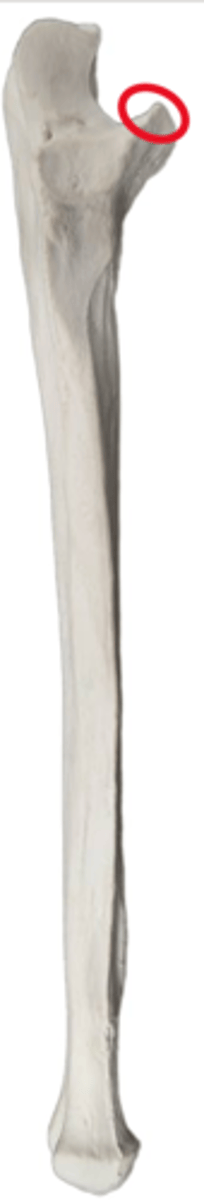 <p>Anterior Proximal Ulnar</p>