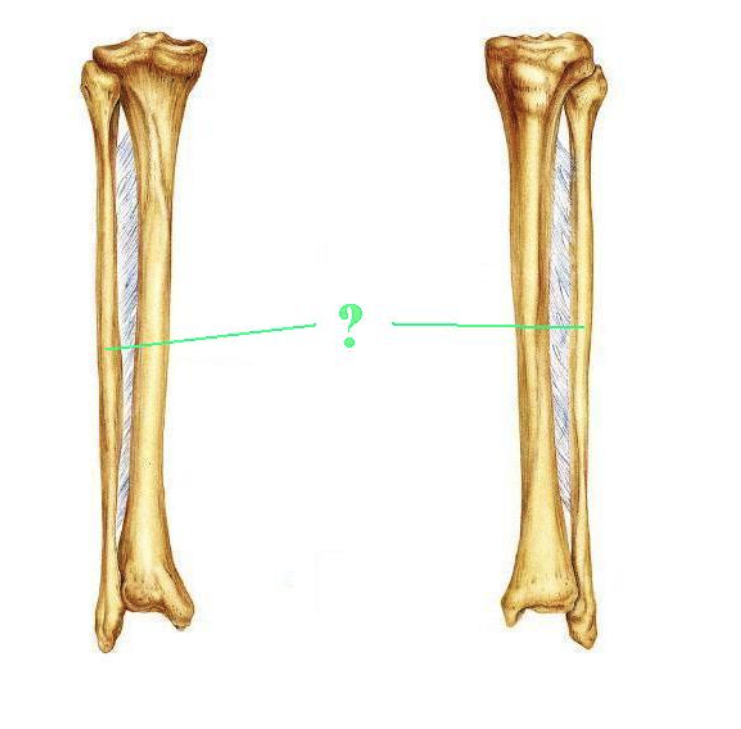 <p><span>Identify the indicated bone.</span></p>