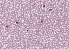 <p>Connective tissue. Scattered cells , Red blood cells, white blood cells and platelet in plasma matrix</p>