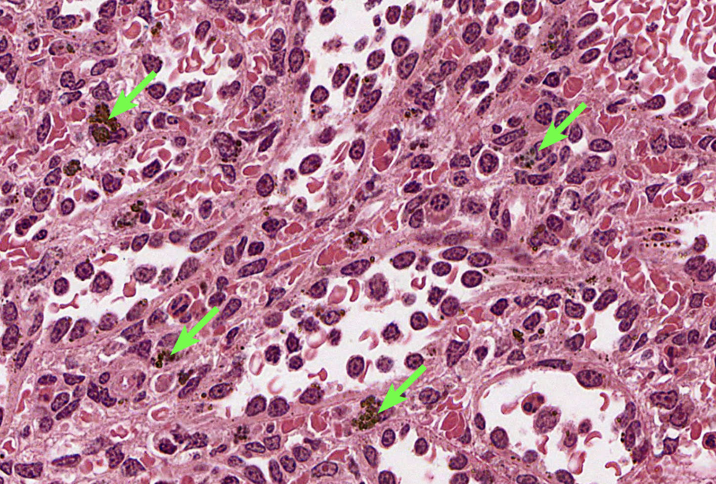 <p>any purple dot</p>