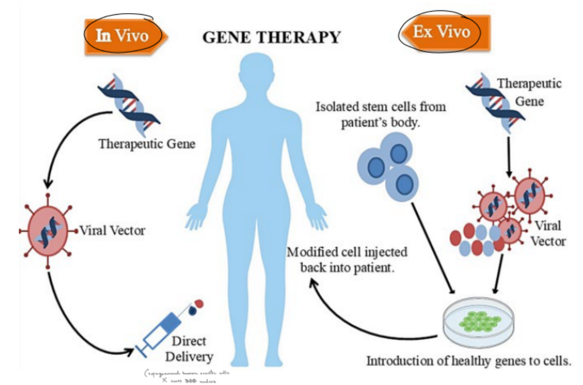 <p><strong><u>in vivo</u></strong> (done inside the body)</p><ul><li><p><u>gene </u>turns into a <u>viral vector</u>, which is then <strong><u>directly </u></strong><u>delivered </u></p></li></ul><p><strong><u>ex vivo</u></strong> (done outside the body, then injected)</p><ul><li><p><u>gene </u>turns into a <u>viral vector</u>, where the <strong><u>viral vector</u> &amp; <u>isolated stem cells from the patient</u></strong> will come together to <u>get a modified cell</u>, which is then <strong><u>injected </u></strong><u>back into the patient</u></p></li></ul><p>_</p><p>true</p><ul><li><p>first successful case done last year in an infant w/ CPS1 deficiency</p></li></ul><p></p>