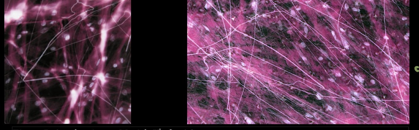 <p>has fibroblasts</p><p>other cells: macrophages, mast cells, fat cells</p>