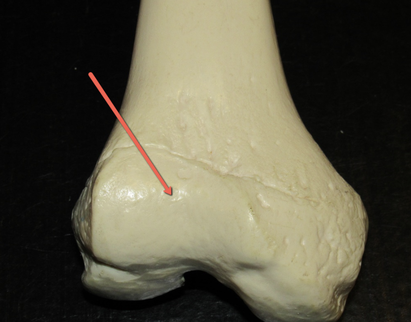 <p><strong>Identify the bone marking indicated by the pointer.</strong></p>