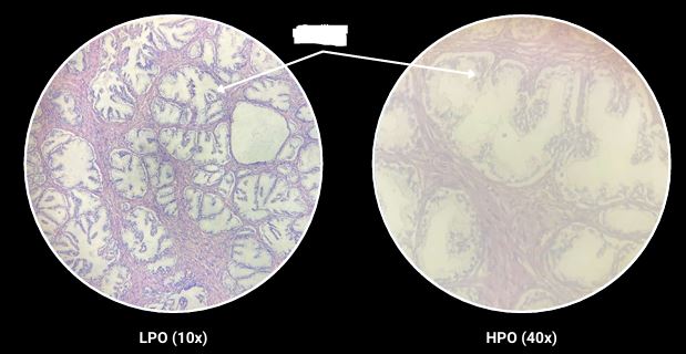 <p>What are the arrows pointing?</p>