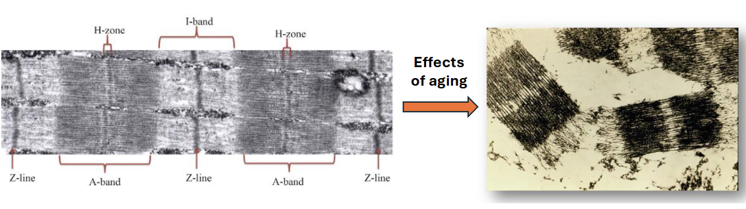 <p>Myofibrils weaken</p><p>Breakage or structural damage near Z line in I band</p>