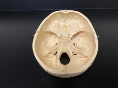 <p>Identify the Structure</p>