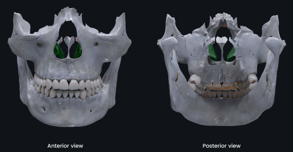 <p>Identify the bone highlighted in green</p>
