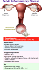 <p>pelvic inflammatory disease</p>