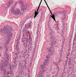 <p>what arrows pointing to (jejunum)</p>