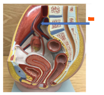 <p>What is the orange arrow?</p>