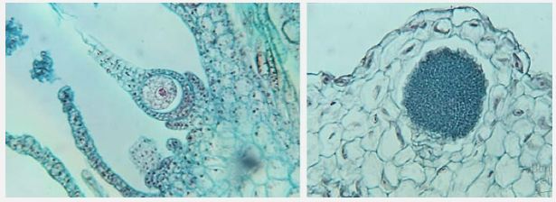 left: archegonia; right: antheridium