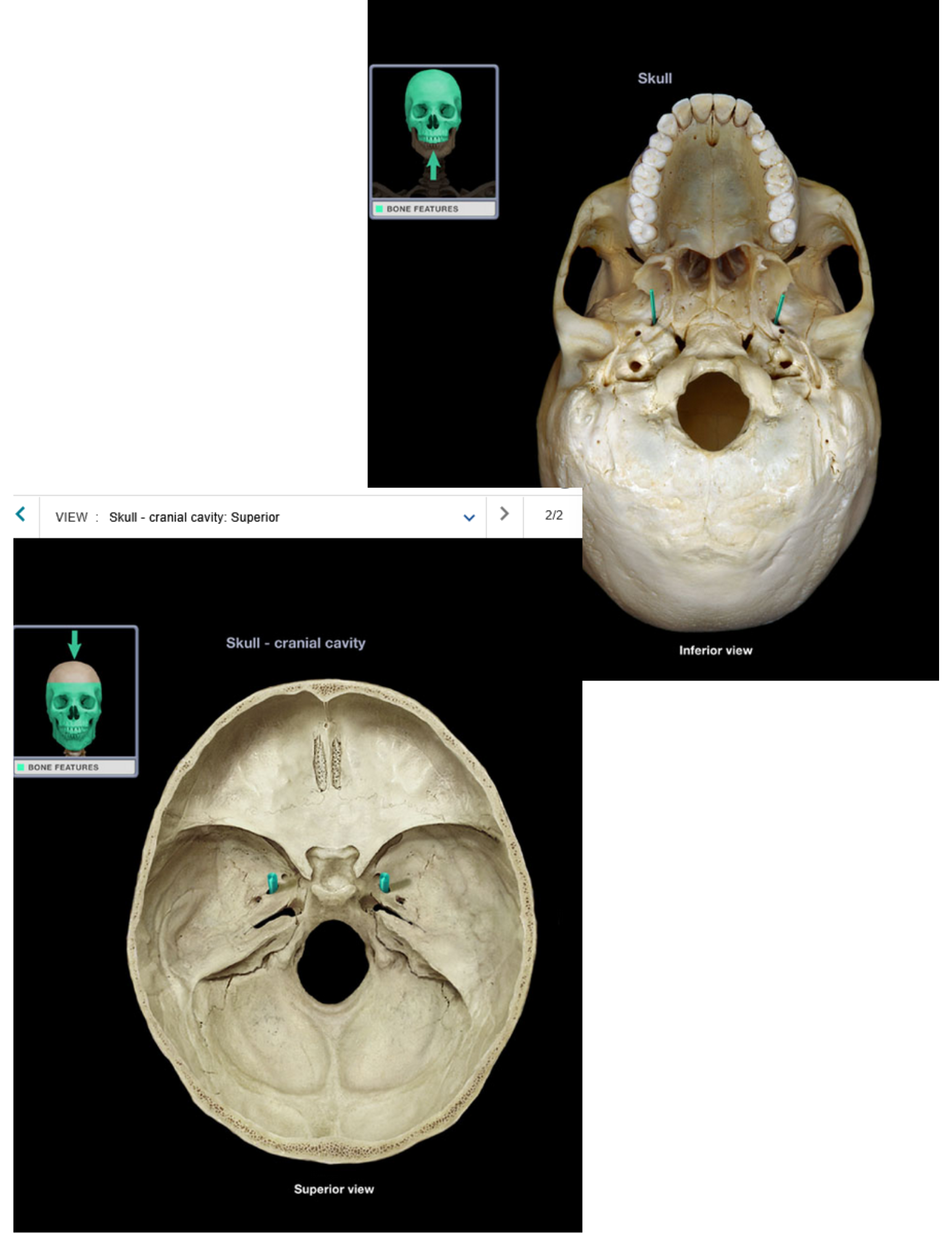 <p>Foramen ovale</p>
