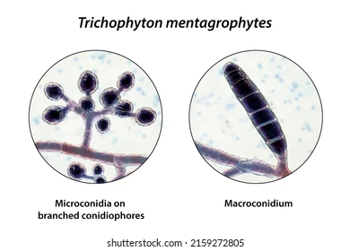 <p>mikrokonidie</p><ul><li><p>malé</p></li><li><p>většinou jednobuněčné konidie</p></li><li><p>u hub tvořících dva typy konidií </p></li></ul><p>makrokonidie</p><ul><li><p>větší</p></li><li><p>většinou mnohobuněčné konidie</p></li><li><p>u hub tvořících dva typy konidií </p></li></ul><p></p>