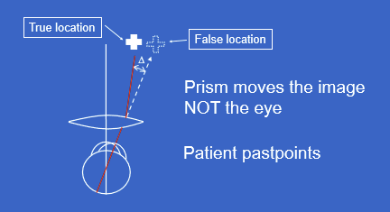 <ul><li><p>The prism effect displaces the image to a false location.</p></li><li><p>The brain interprets the displaced image as real.</p></li><li><p>Increased eye rotation causes reaching movements that overshoot the true target.</p></li></ul><p></p>