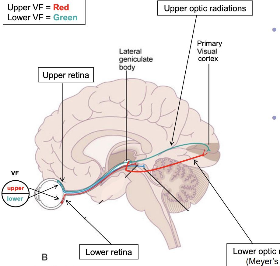 <ul><li><p>info from lower visual field goes to upper retina </p><ul><li><p>once in LGN, axons use upper optic radiations (parietal lobe) to synapse in cuneate gyrus </p></li></ul></li><li><p>info from upper visual field goes to lower retina </p><ul><li><p>once in LGN, axons use lower optic radiations (temporal lobe) to synapse in lingual gyrus </p></li></ul></li></ul><p></p>