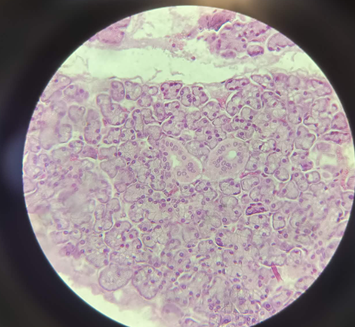 <p>Glandula Parotis - HE (28)</p><p></p><ul><li><p>Big saliva gland located behind the ears</p></li><li><p>Has fat tissue</p></li><li><p>contains only serosa acini (circular nucleus, with pyramidal outline, new epithelial cells, no lumen) (with ribosomes, produces protein rich solutions)</p></li><li><p>Epithelium: Cuboidal Epithelium</p></li></ul><p></p>