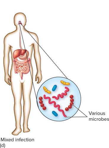 <p>Several agents establish themselves simultaneously at the infection site.</p>