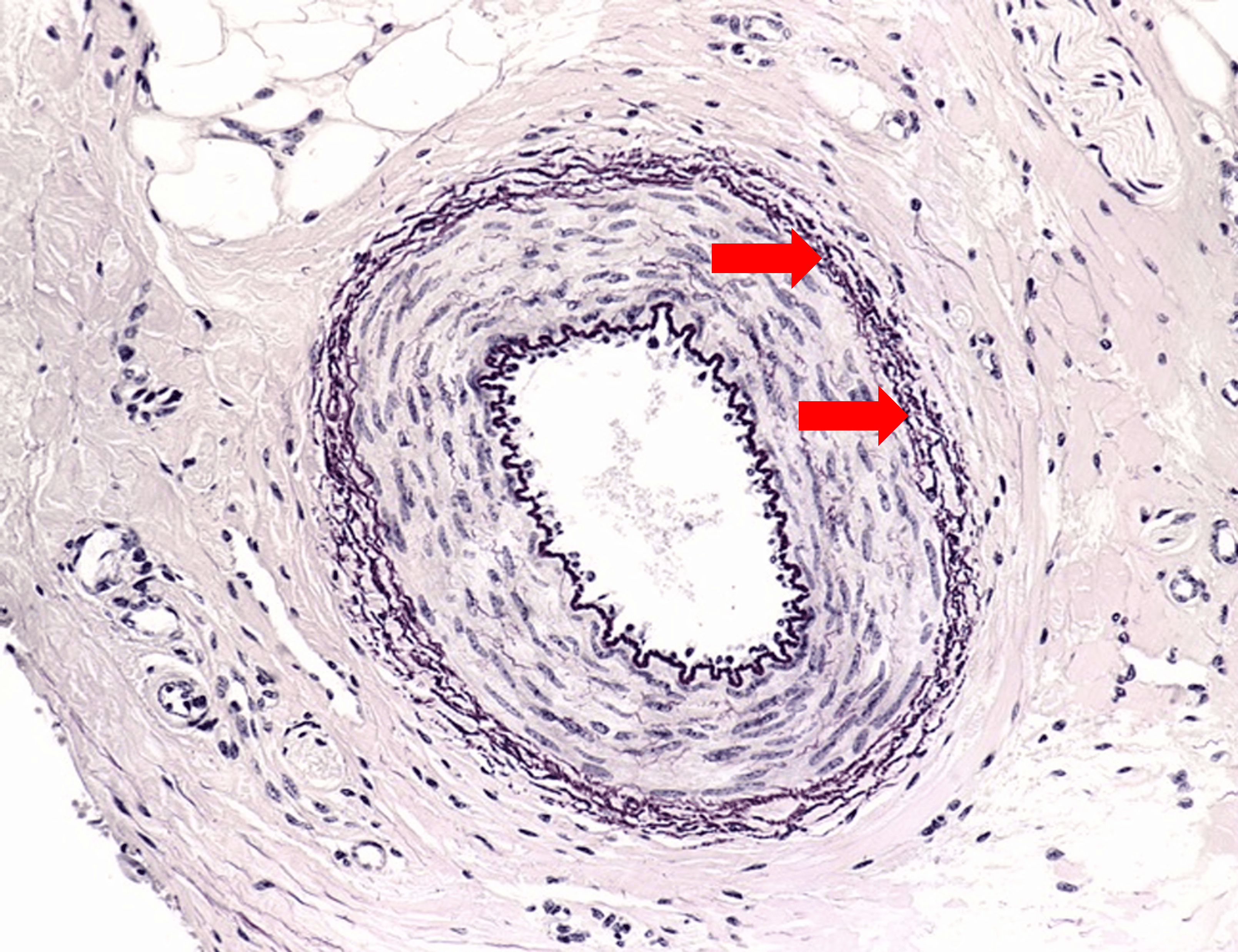 term image