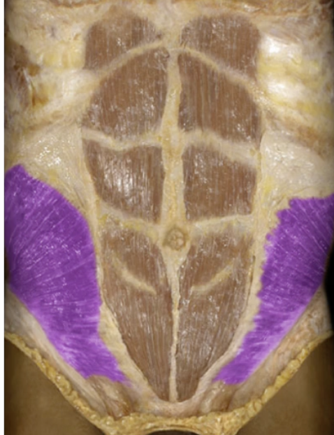 <p>Name muscle that gives six pack abs</p>