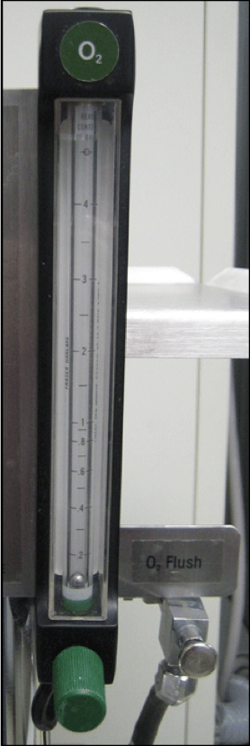 <p>what is this whole thing. then what is the grey knob </p>