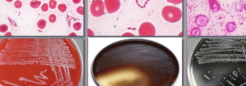 <p>GNR, safety pin (pleomorphic), ANA BAP, BBE, KV Agar, disks (K, V, C, bile resistant)</p>
